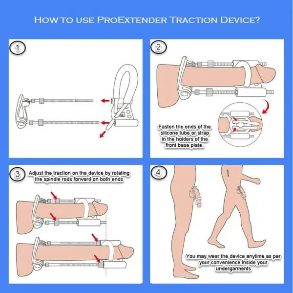 Pro Extender Penis Enlargement Device